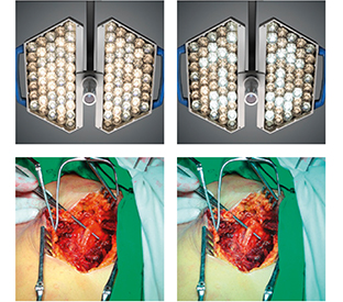  Lámpara Quirúrgica TruLight™ 5000